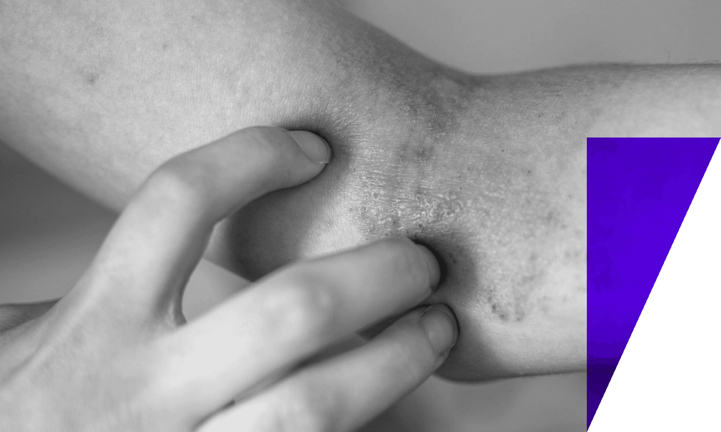 person scratching their skin